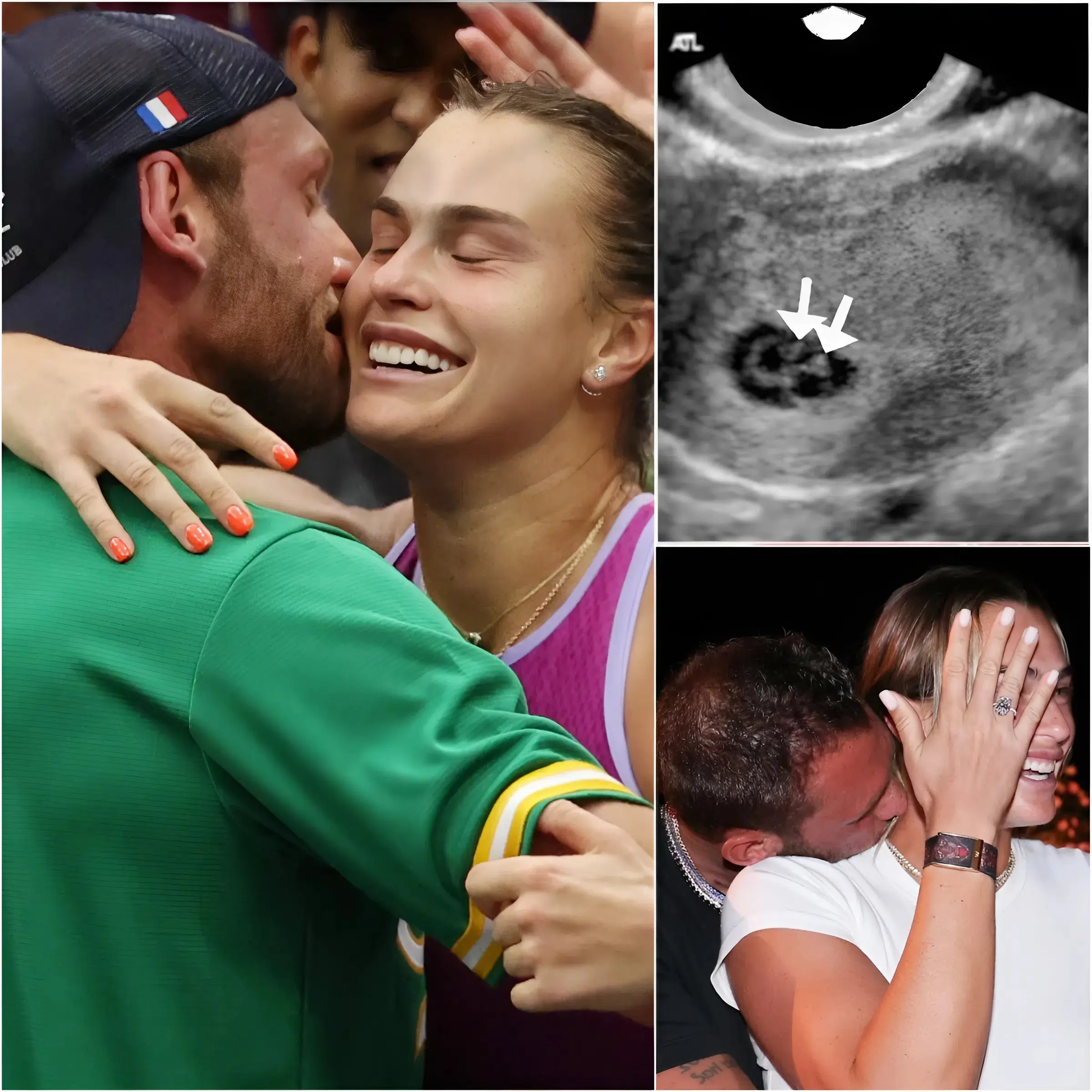 Cover Image for 🎉❤️CONGRATULATIONS: At the height of her career, Aryna Sabalenka unexpectedly caused a stir in the tennis world when she quietly revealed she was pregnant with her boyfriend Georgios Frangulis.