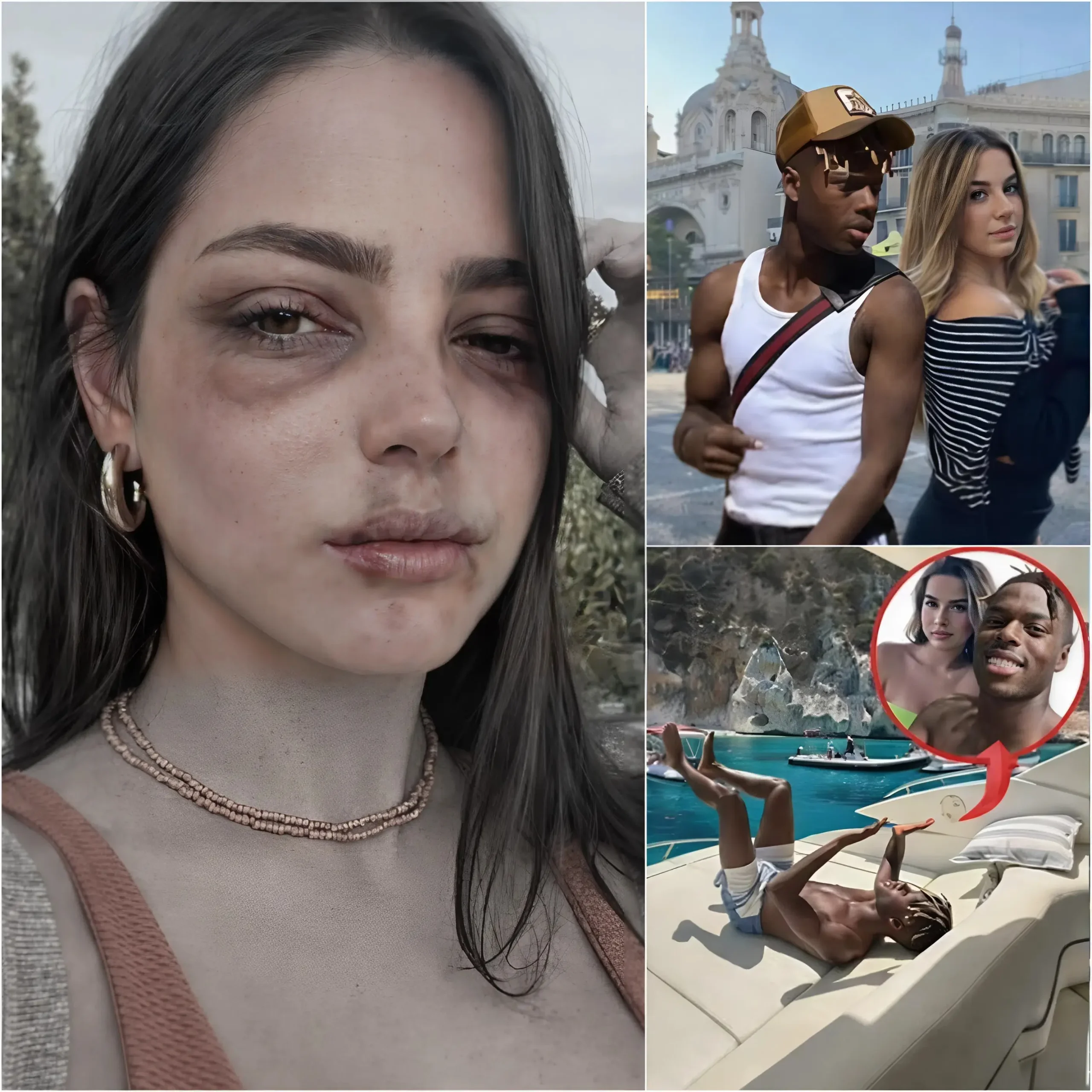 Cover Image for 😱 NOTICIA DE ÚLTIMA HORA: Ainhi García ha publicado un vídeo de 1 minuto y 15 segundos que supuestamente muestra a Nico abofeteándola, junto con una serie de imágenes que muestran sus lesiones y pruebas de la infidelidad de Nico, reavivando la polémica y causando gran conmoción entre los aficionados.