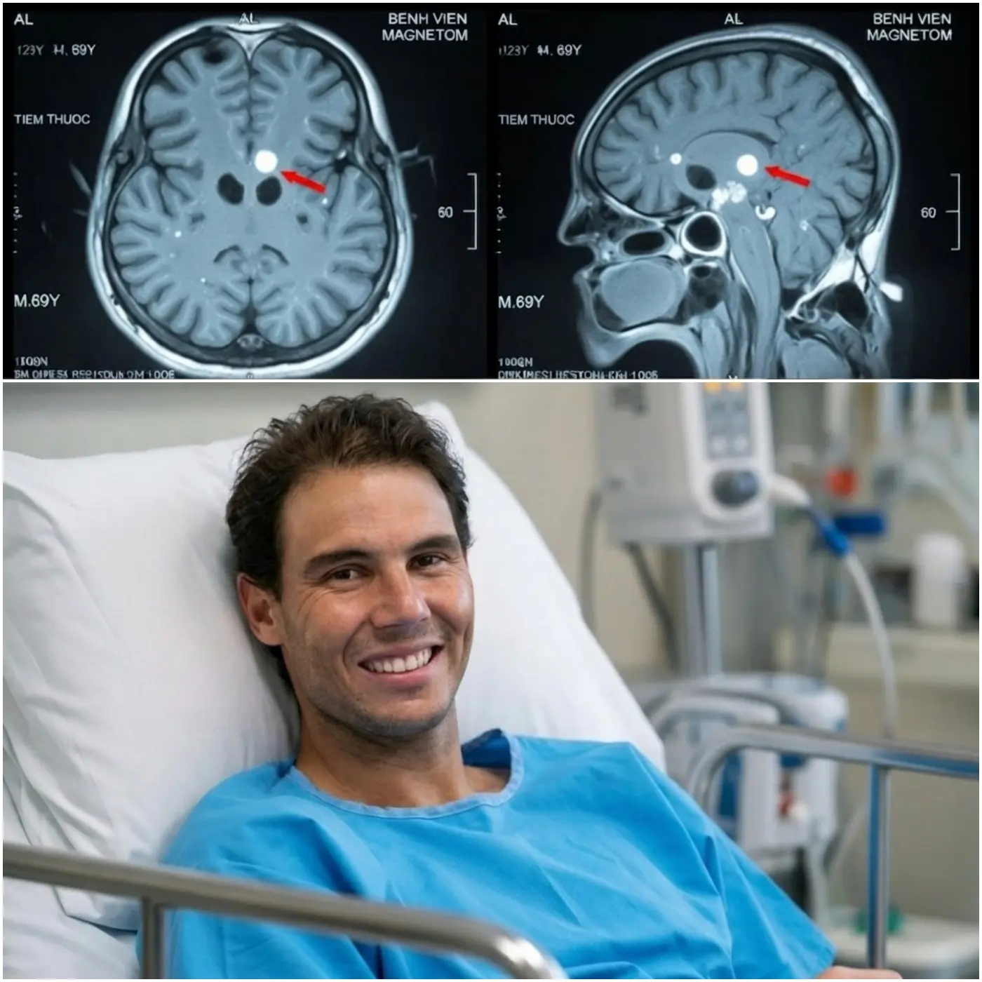 Cover Image for 💔 CROLLATO DIETRO LA GLORIA: Rafael Nadal affronta una crisi sanitaria ed emotiva superiore