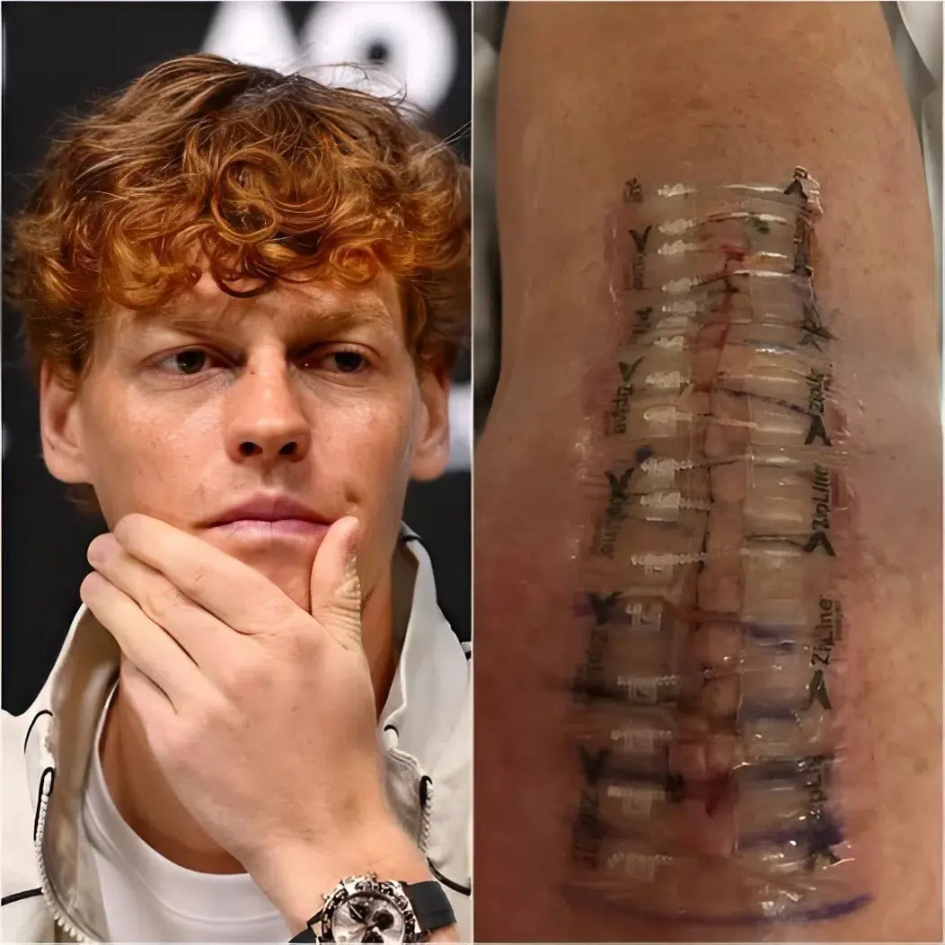 Cover Image for 💝 BUENAS NOTICIAS DE Jannik Sinner: Un mensaje conmovedor tras la operación 💬 “Todavía tengo un largo camino por delante. Pero creo en la curación — a través del amor, a través de la verdad y a través de las oraciones de todos ustedes.”