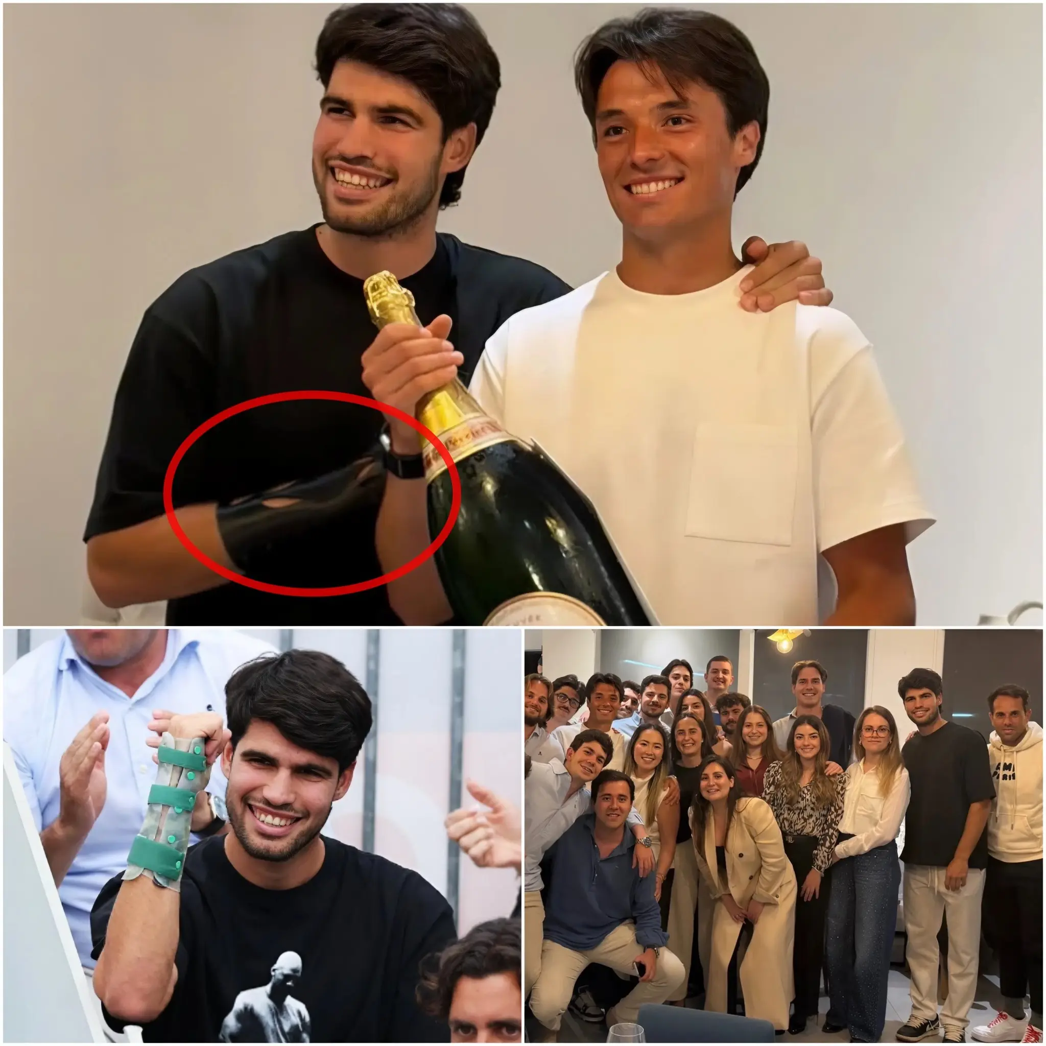 Cover Image for GOOD NEWS for Carlos Alcaraz Fans! ❤️ Carlos Alcaraz has taken a major step in his recovery, switching from a rigid brace to a semi-rigid brace.
